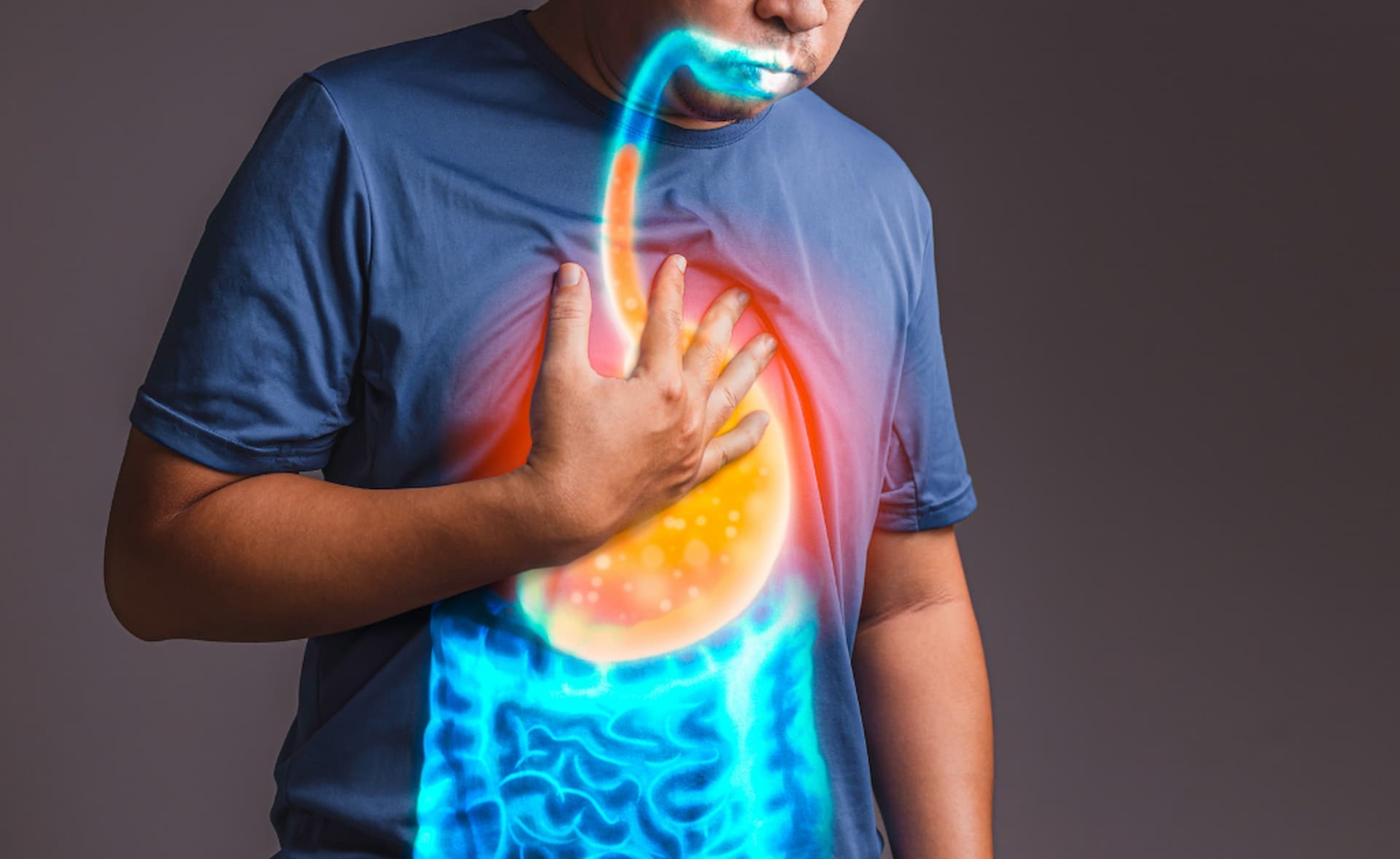 Lưu ý chăm sóc cho người bị trào ngược dạ dày